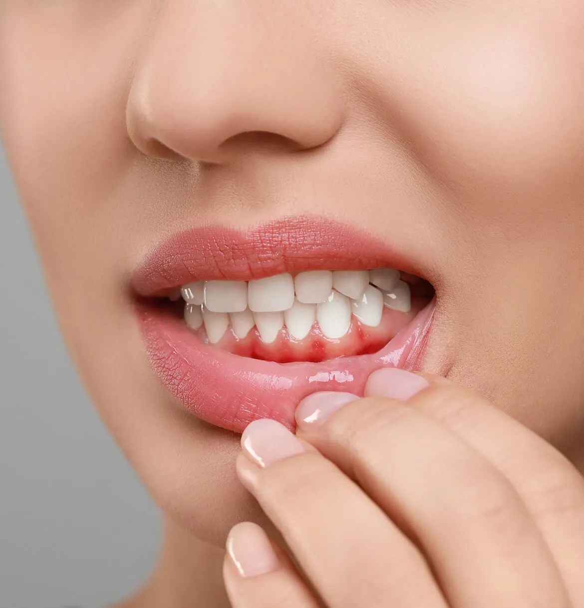 pomogaet-li-hlorgeksidin-pri-vospalenii-desen-preview-webp