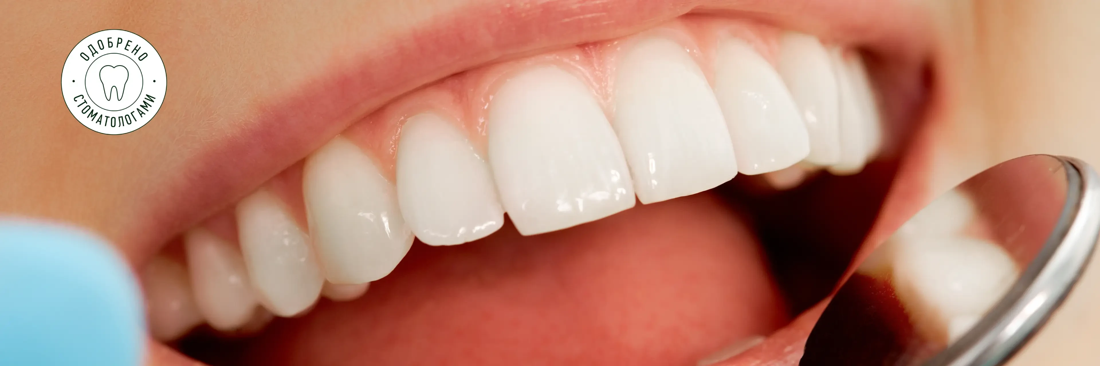 Изображение Чем отличается профессиональное отбеливание от домашних средств: советы стоматолога