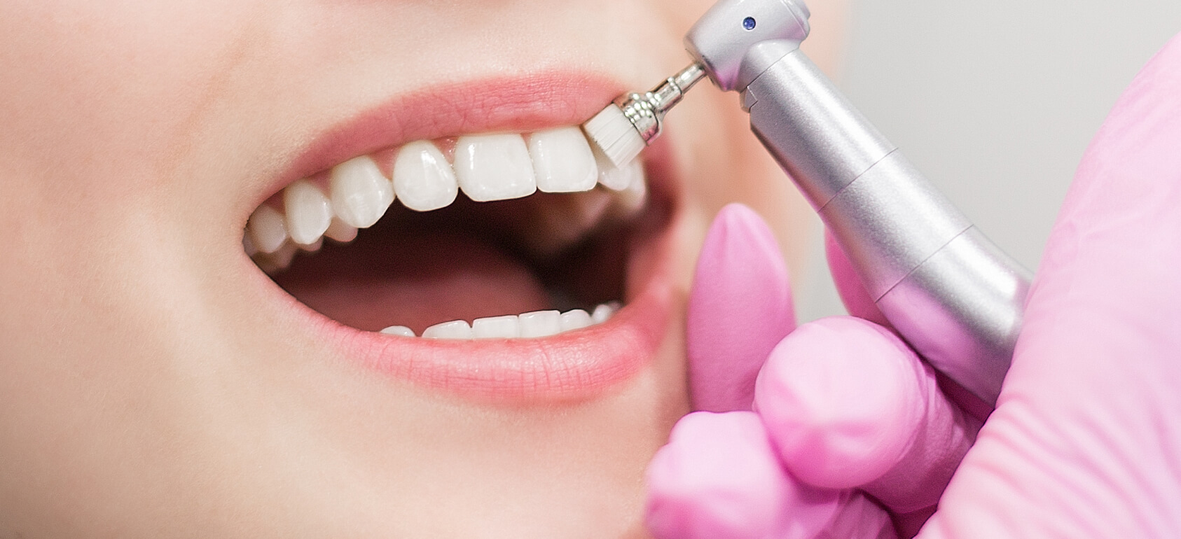 Белые пятна на зубах: почему появляются и как убрать: Изображение 1
